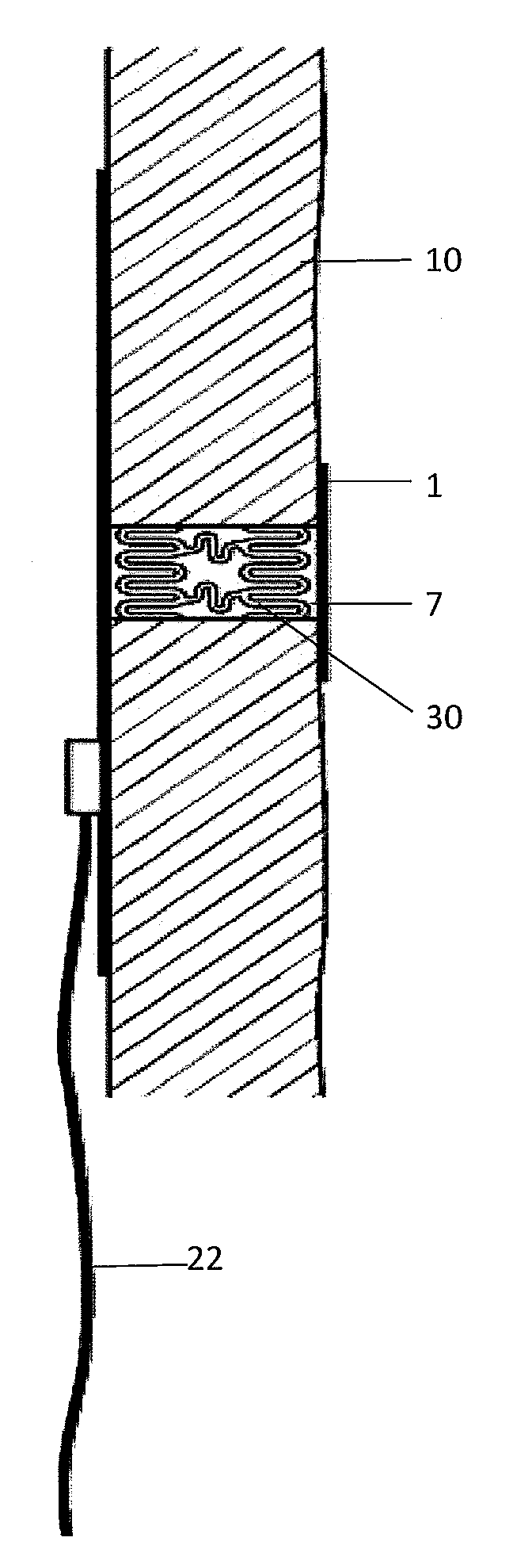 Implantable indifferent reference electrode pole