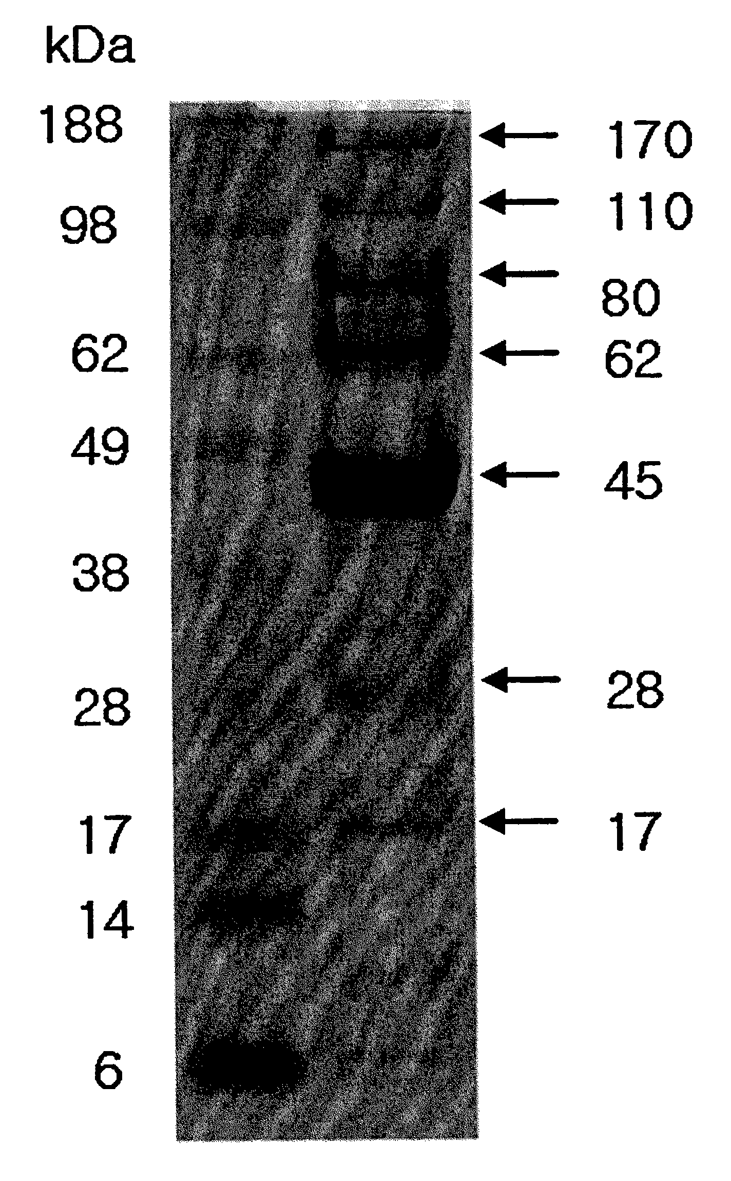 Novel bacteriophage and antibacterial composition comprising same