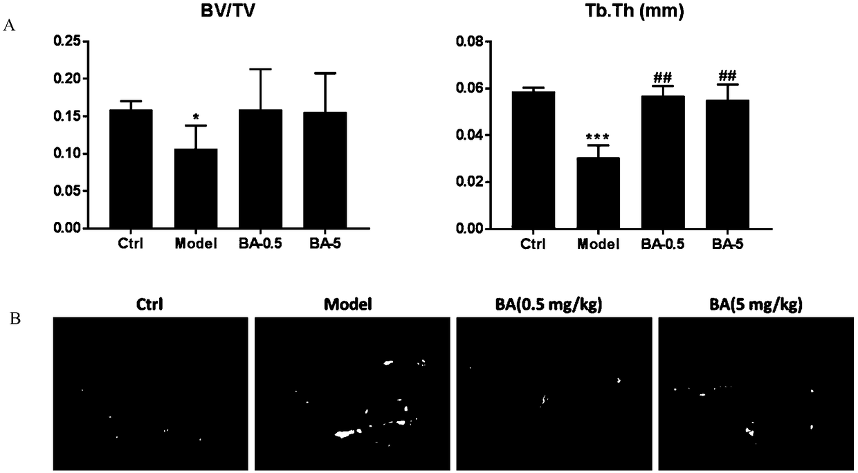 Application of bruceine A in preparation of drug for prevention and treatment of osteoporosis