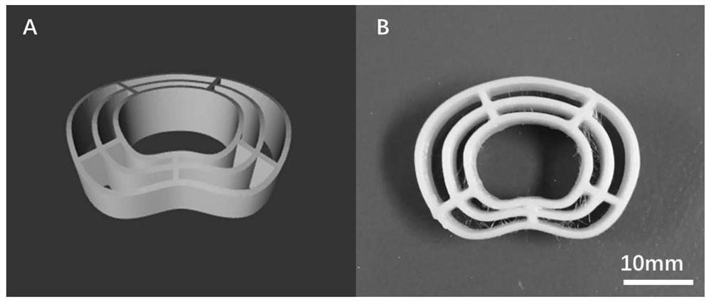 Hydrogel artificial cervical intervertebral disc based on stent reinforcement and preparation method thereof