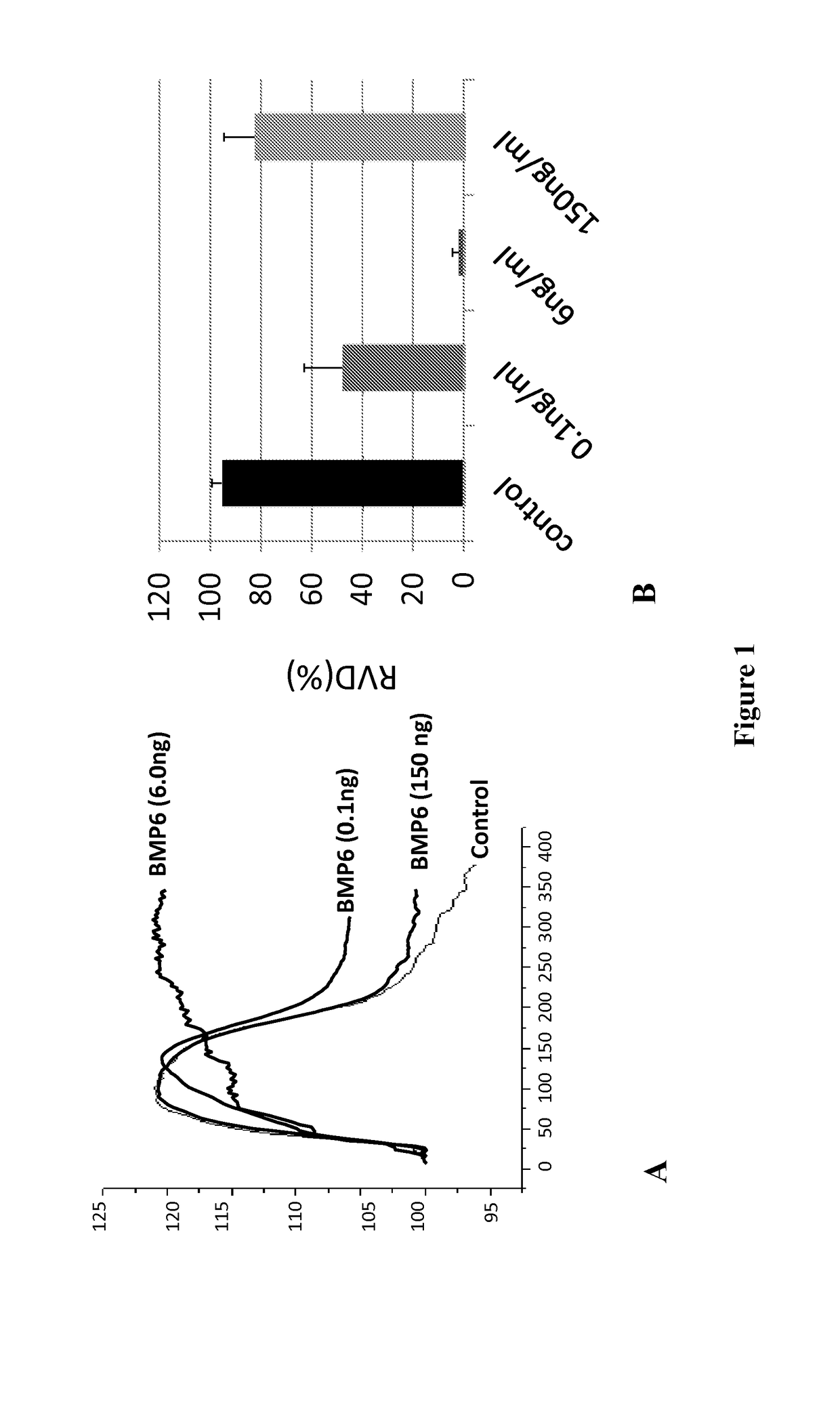 AAV mediated aquaporin gene transfer to treat Sjogren's syndrome