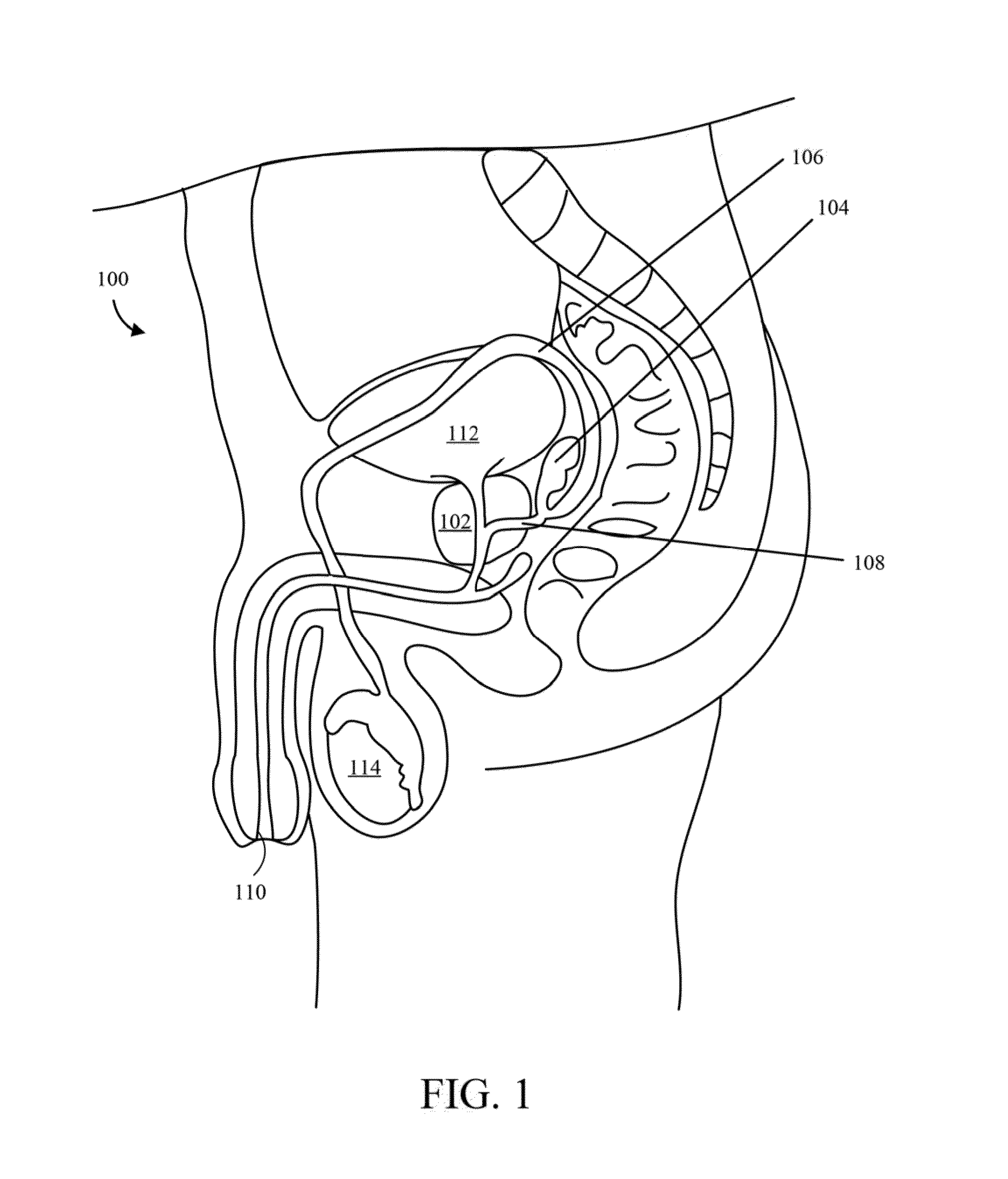 Implantable drug delivery device and methods