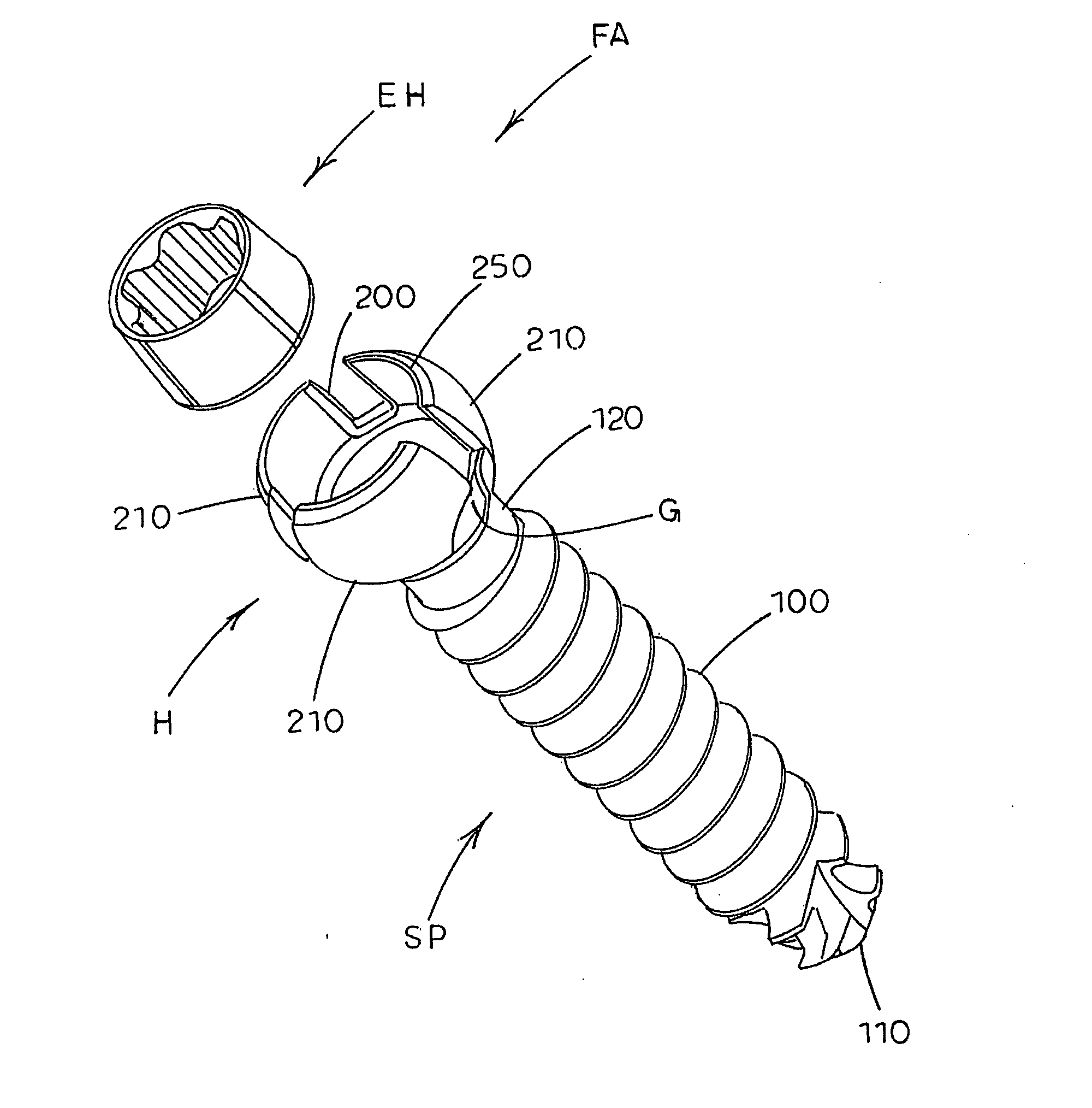 Systems and methods for bone fixation