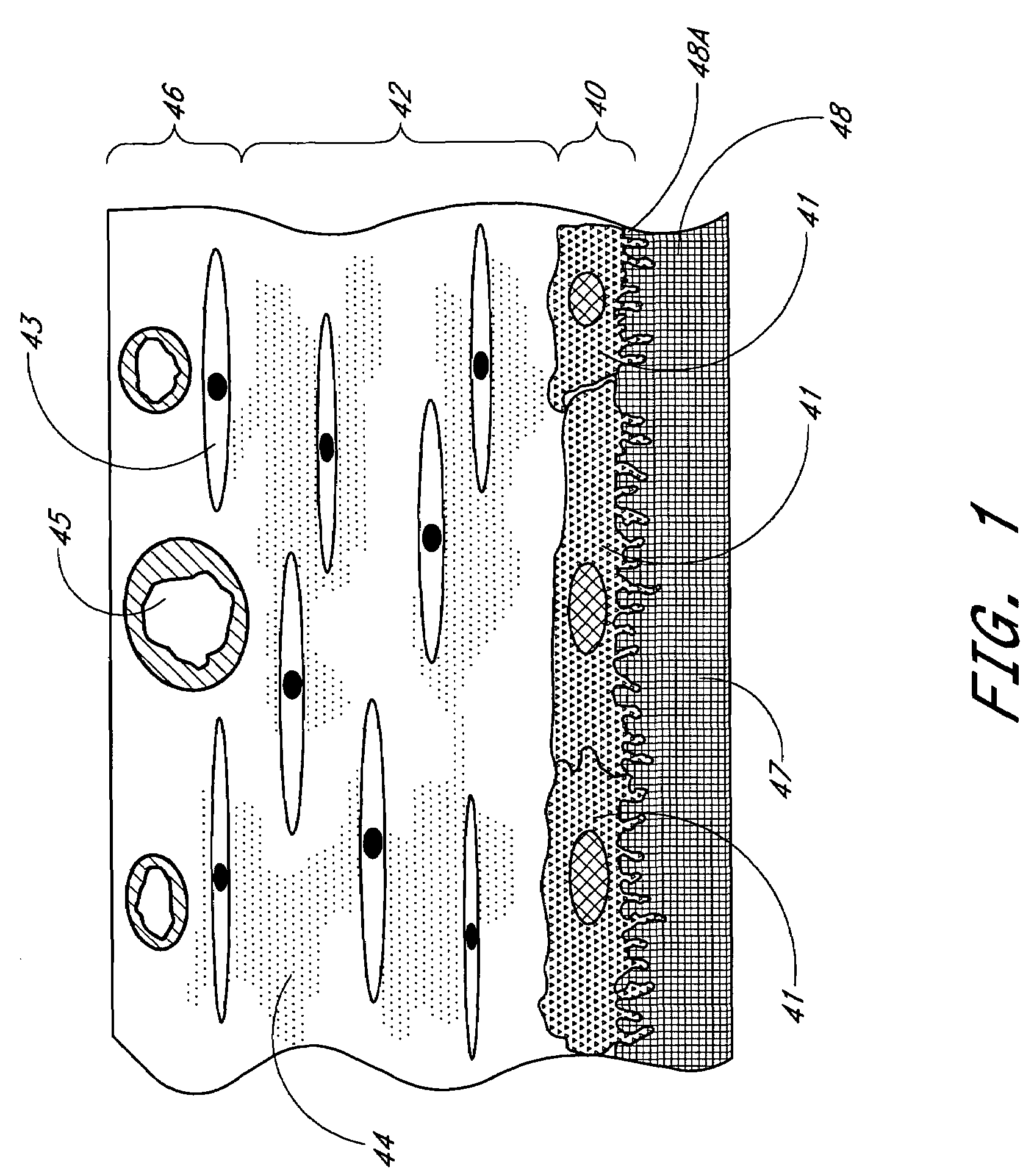 Membrane for use with implantable devices