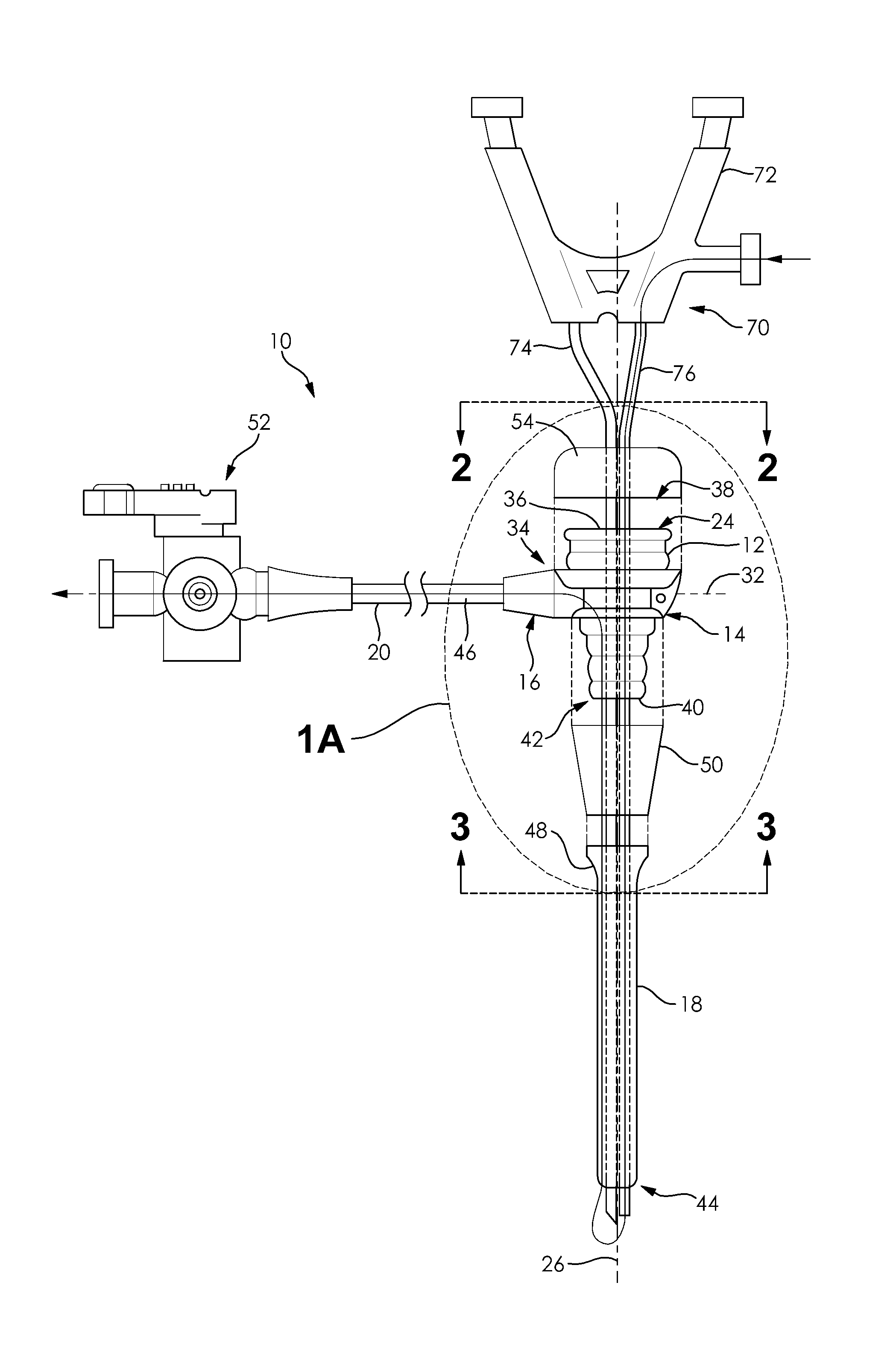 Suction Lithotripsy Apparatus, Method and Kit