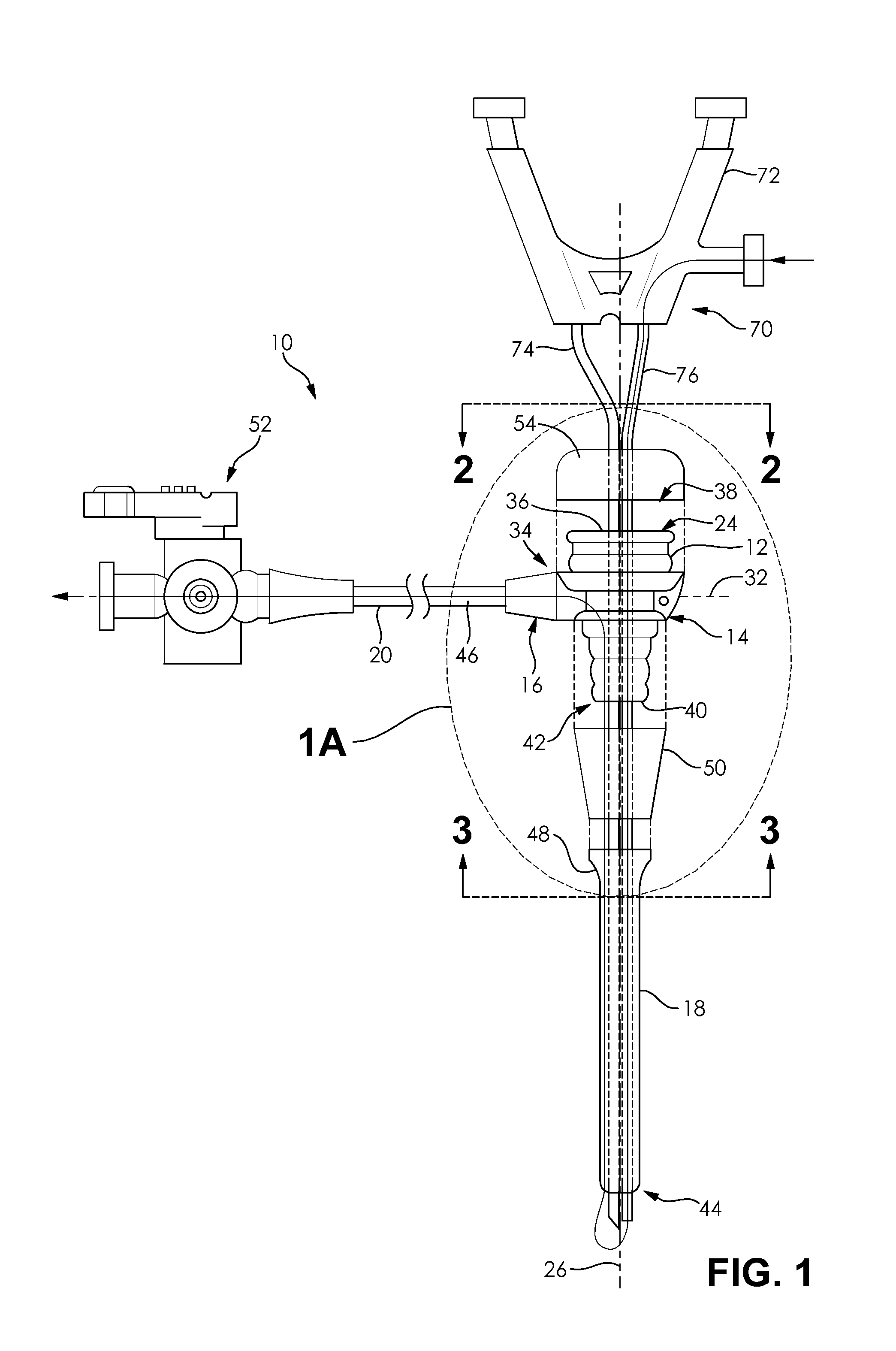 Suction Lithotripsy Apparatus, Method and Kit