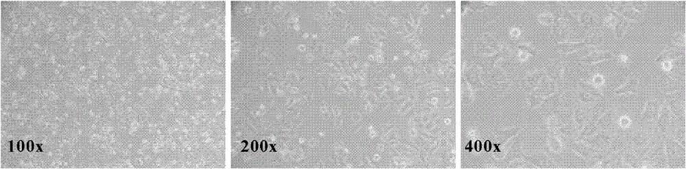 Establishment and application of liver cancer cell line hcc-ly10