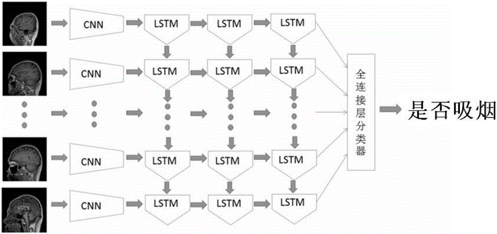 Method for processing head structure image data based on deep learning algorithm