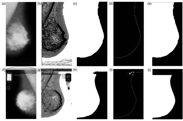Breast region segmentation and calcification detection method in mammography images