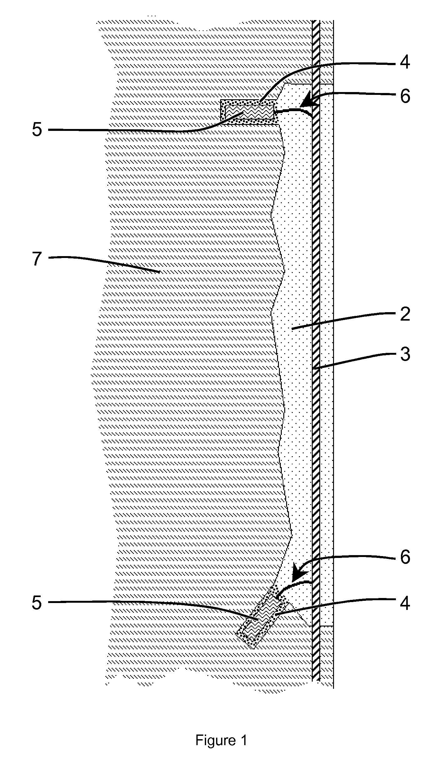 Sacrificial Anodes in Concrete Patch Repair