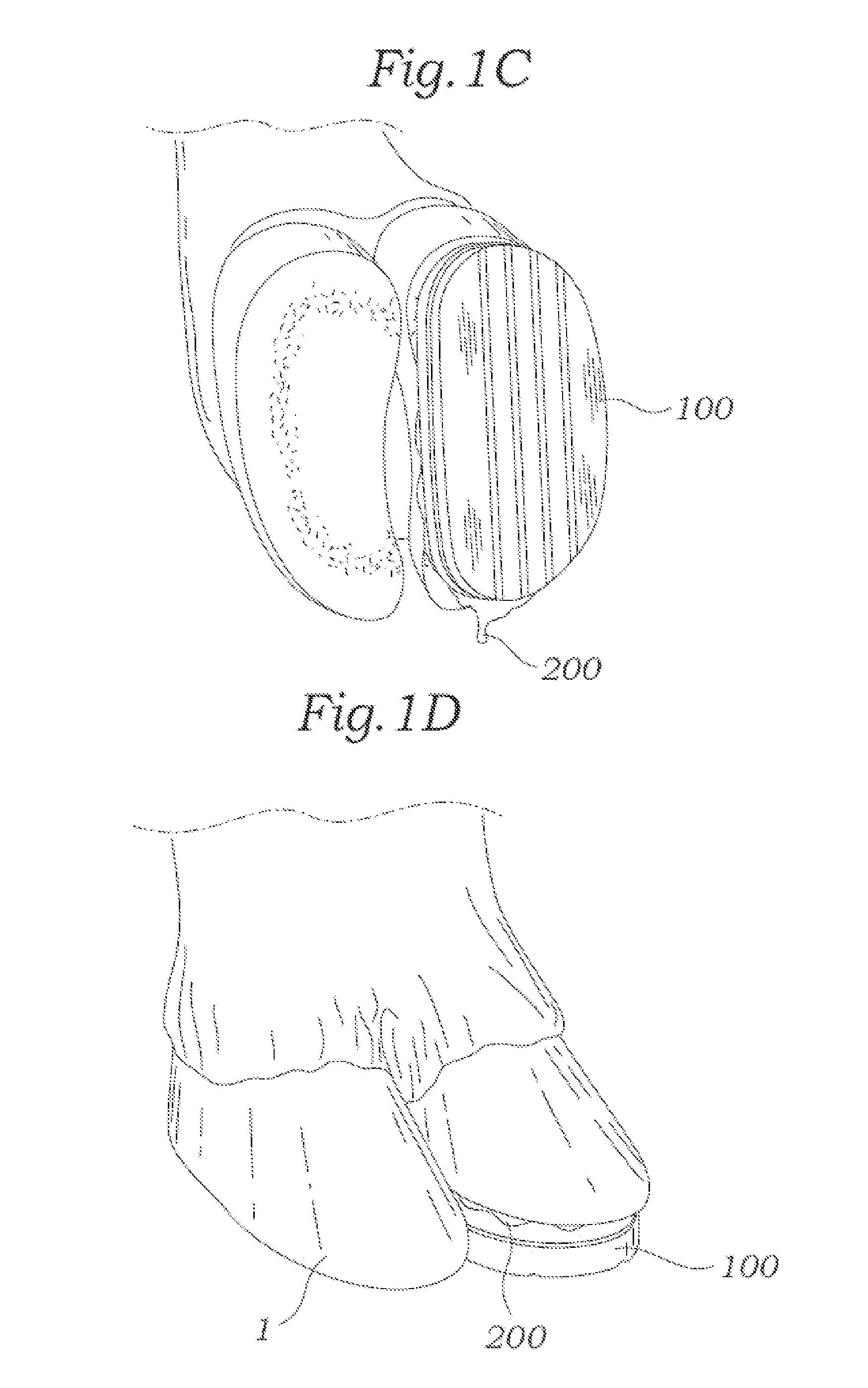 Methods and compositions for treating a hoof of an ungulate animal