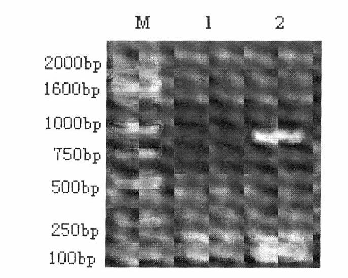 Construction of carriers for prokaryotic expression and eukaryotic expression of candidate gene of porcine rota virus vaccines