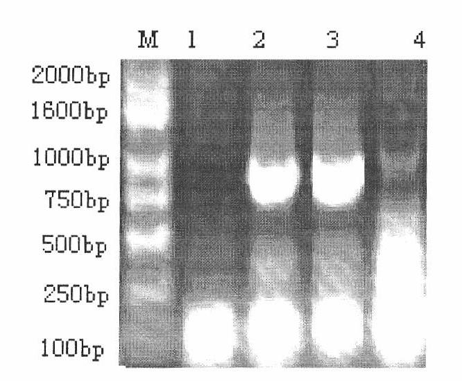 Construction of carriers for prokaryotic expression and eukaryotic expression of candidate gene of porcine rota virus vaccines