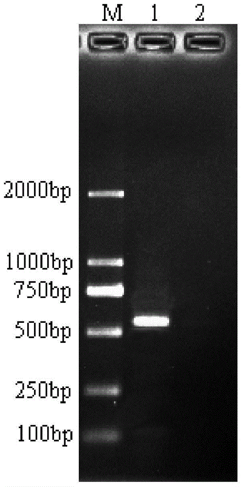 Zhebaizhu pcr identification kit and identification method