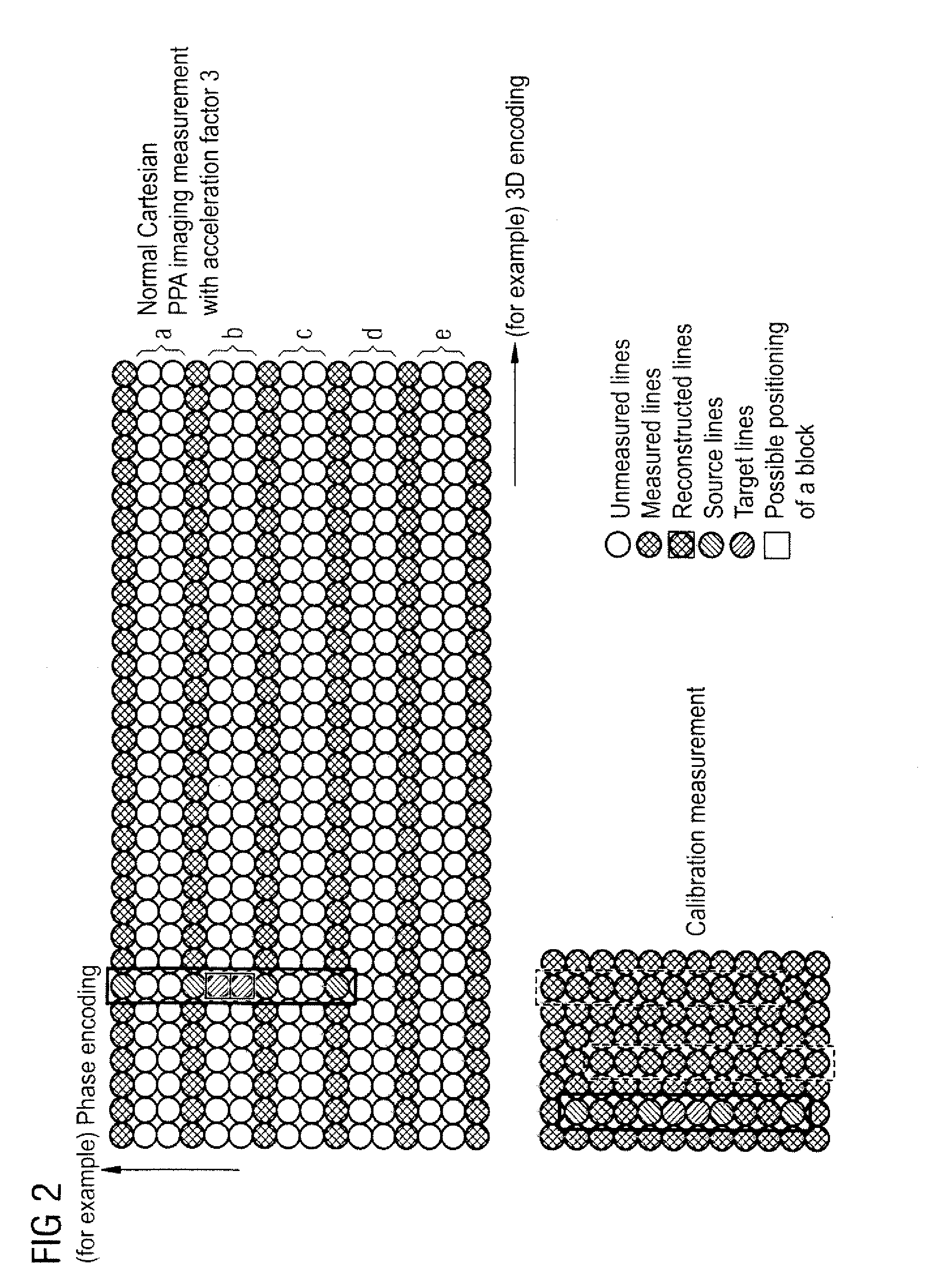 Method and apparatus for sensitivity-encoded magnetic resonance imaging using an acquisition coil array
