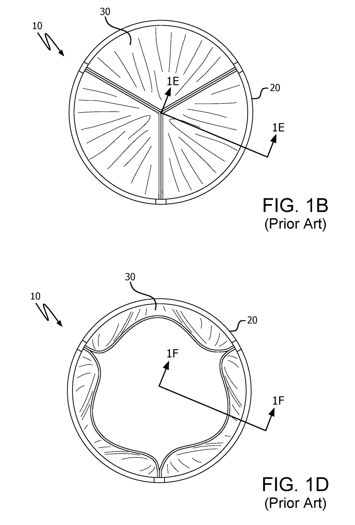 Prosthetic valve with improved washout