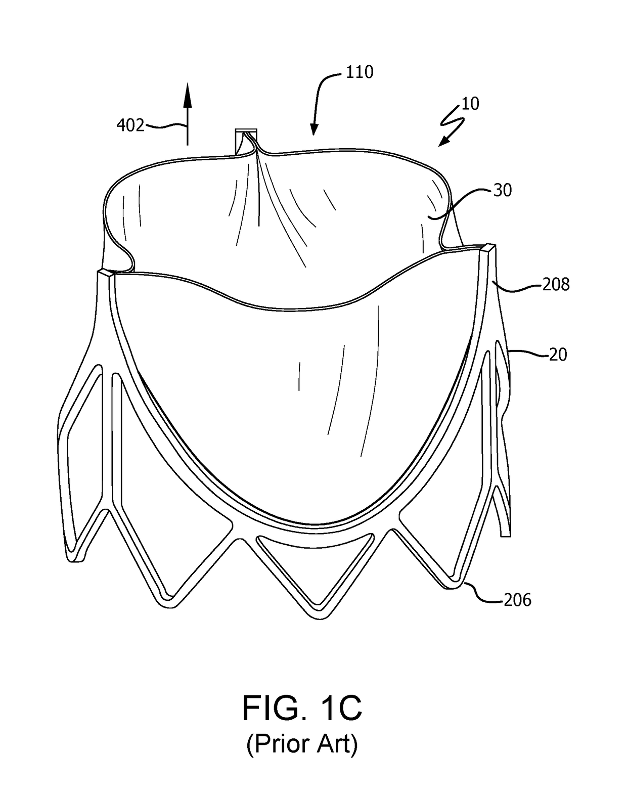 Prosthetic valve with improved washout