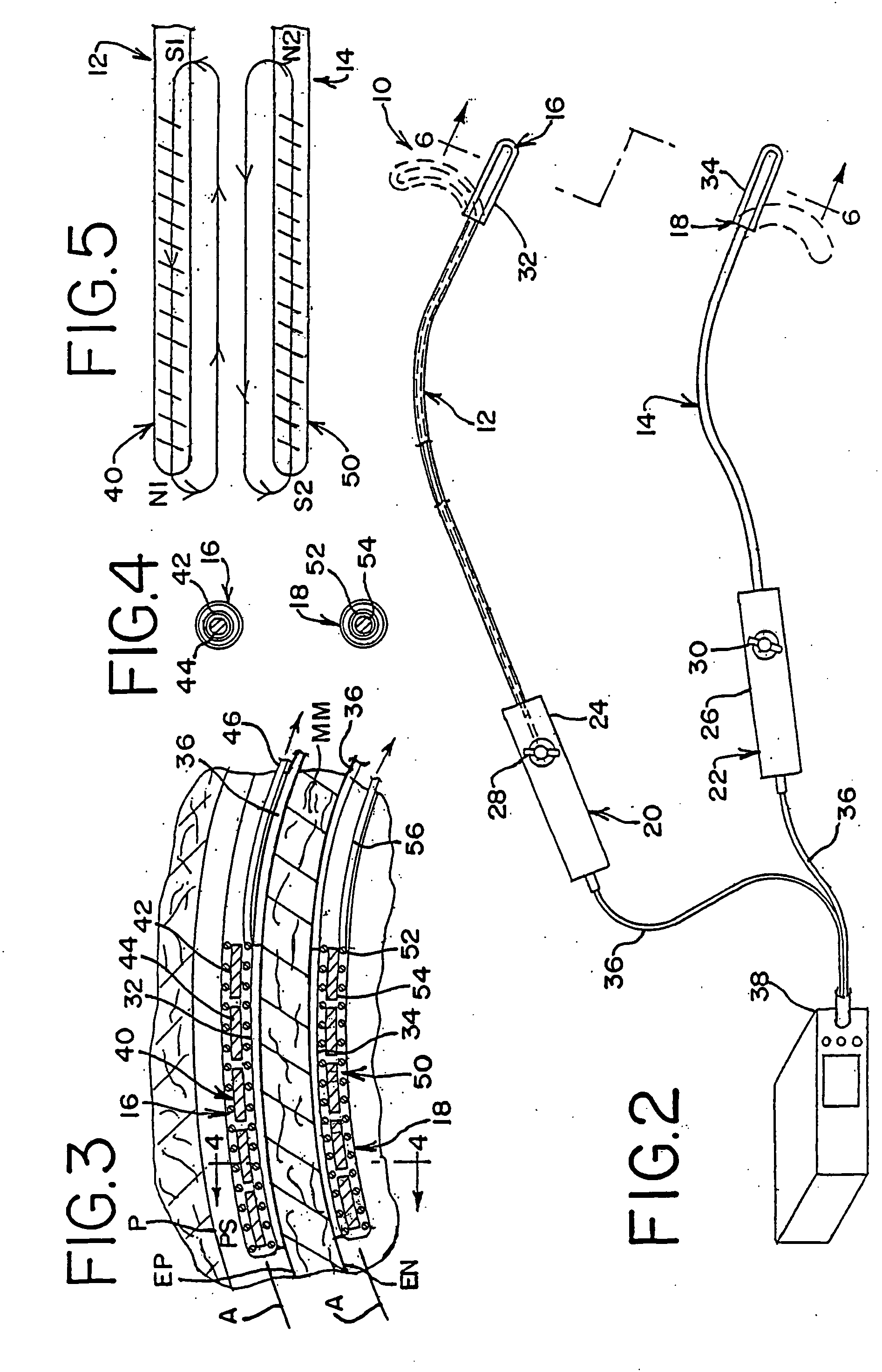 Magnetic catheter ablation device and method