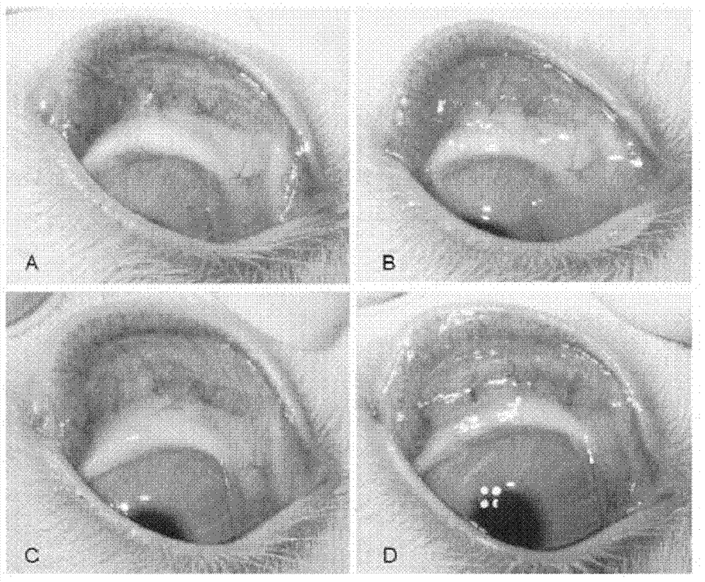 Application of pirfenidone in preparation of medicaments for controlling proliferative diseases after ophthalmologic operation and eye drops thereof