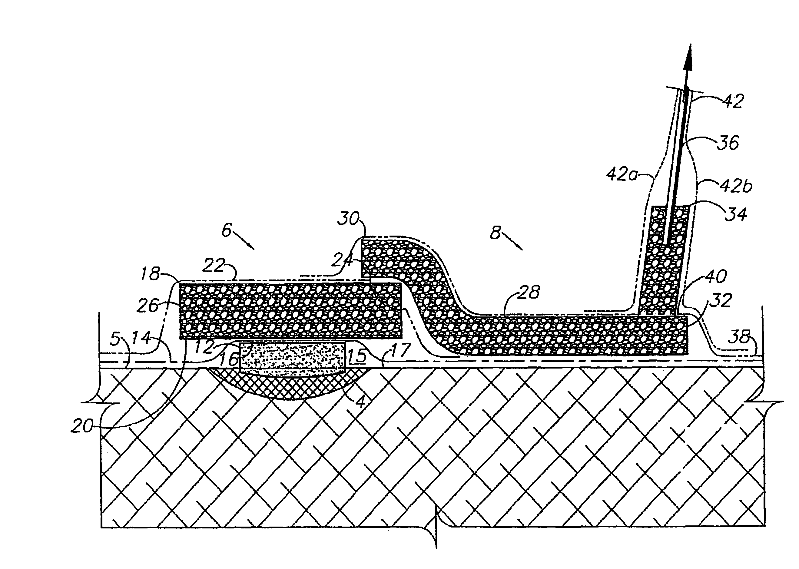 Wound therapy and tissue management system and method with fluid differentiation