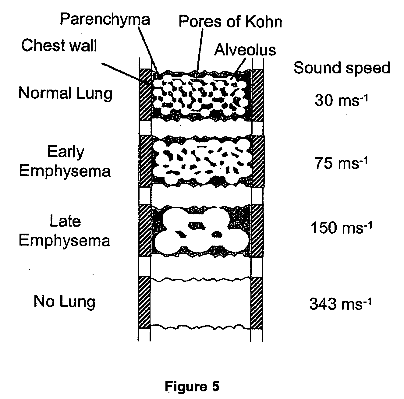 Apparatus and method for lung analysis