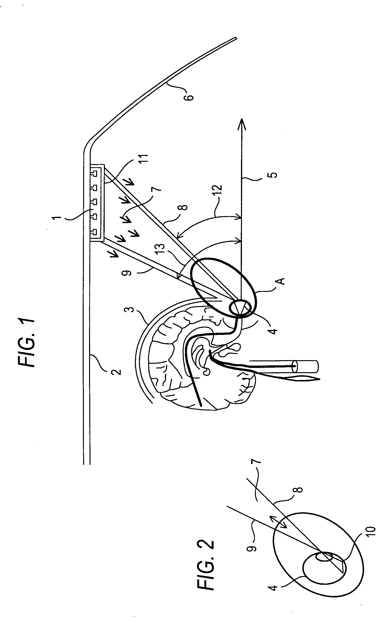 Phototherapy device