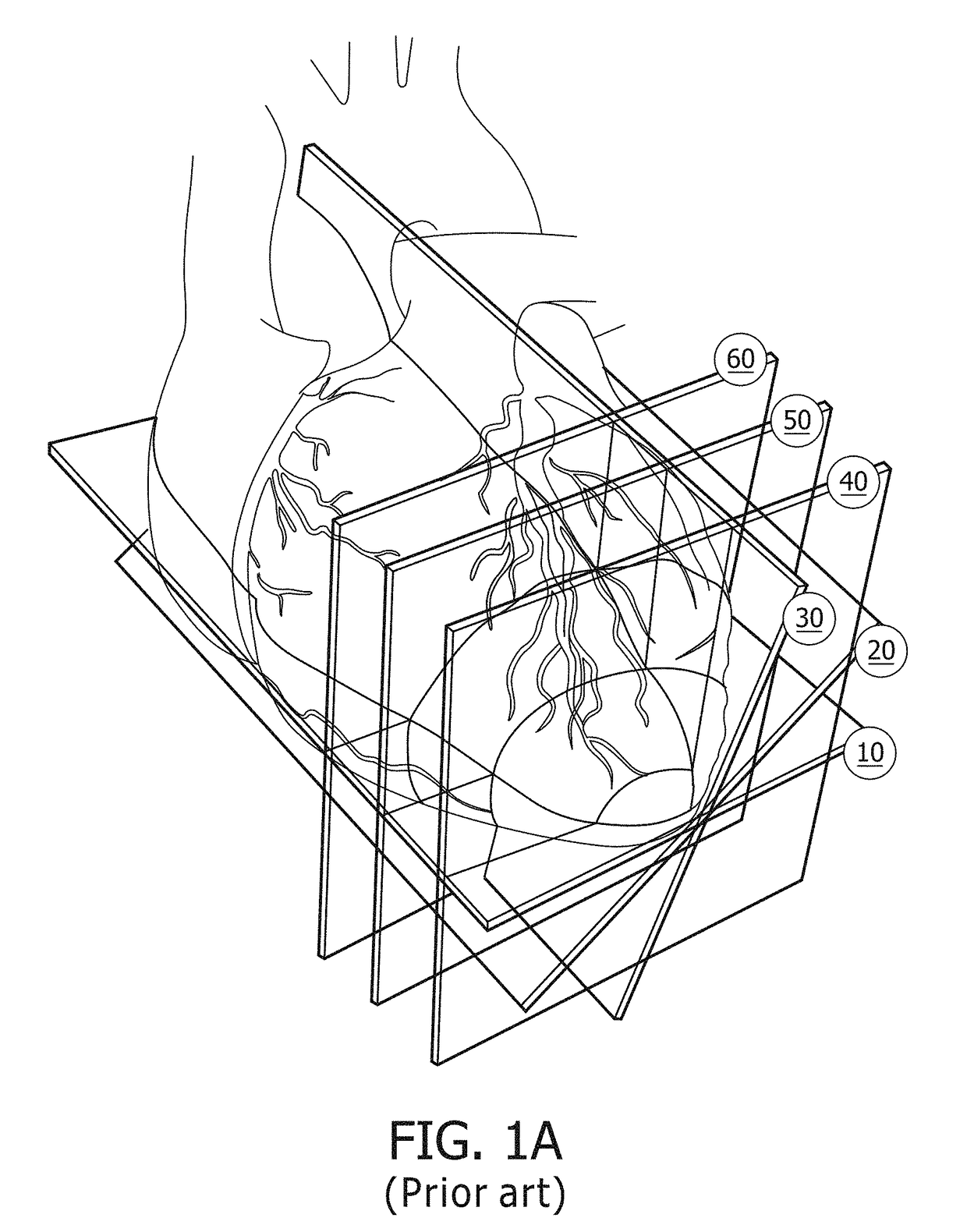 Convolutional deep learning analysis of temporal cardiac images