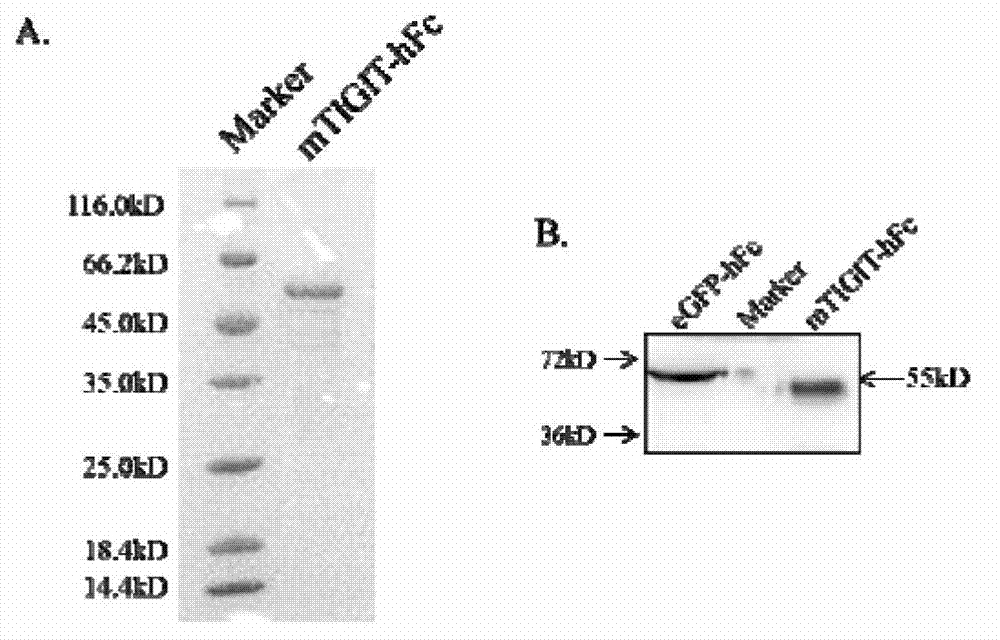 Specific anti-mouse TIGIT monoclonal antibody and preparation method, identification and application thereof