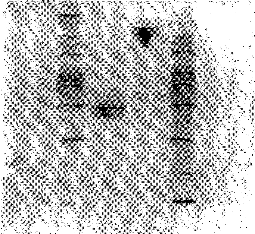 Exendin-4 and analog fusion protein thereof