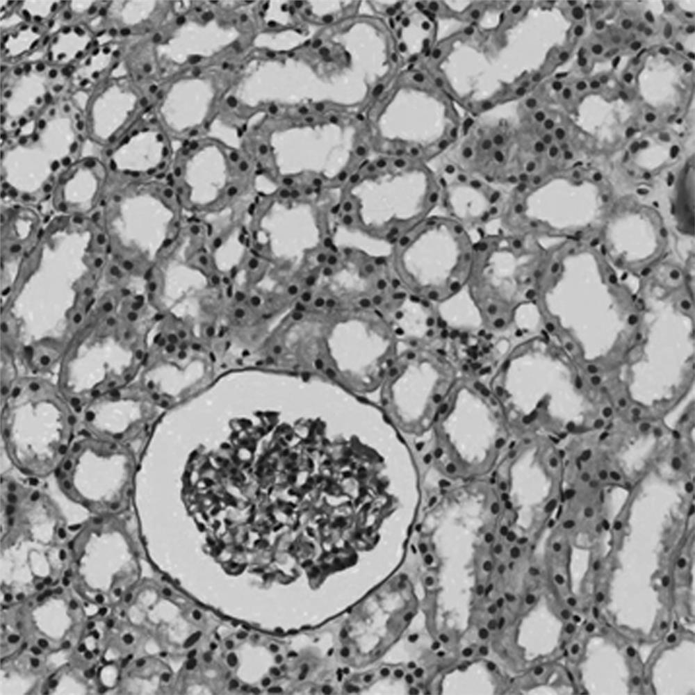 Renal tubule detection and segmentation method based on UNET