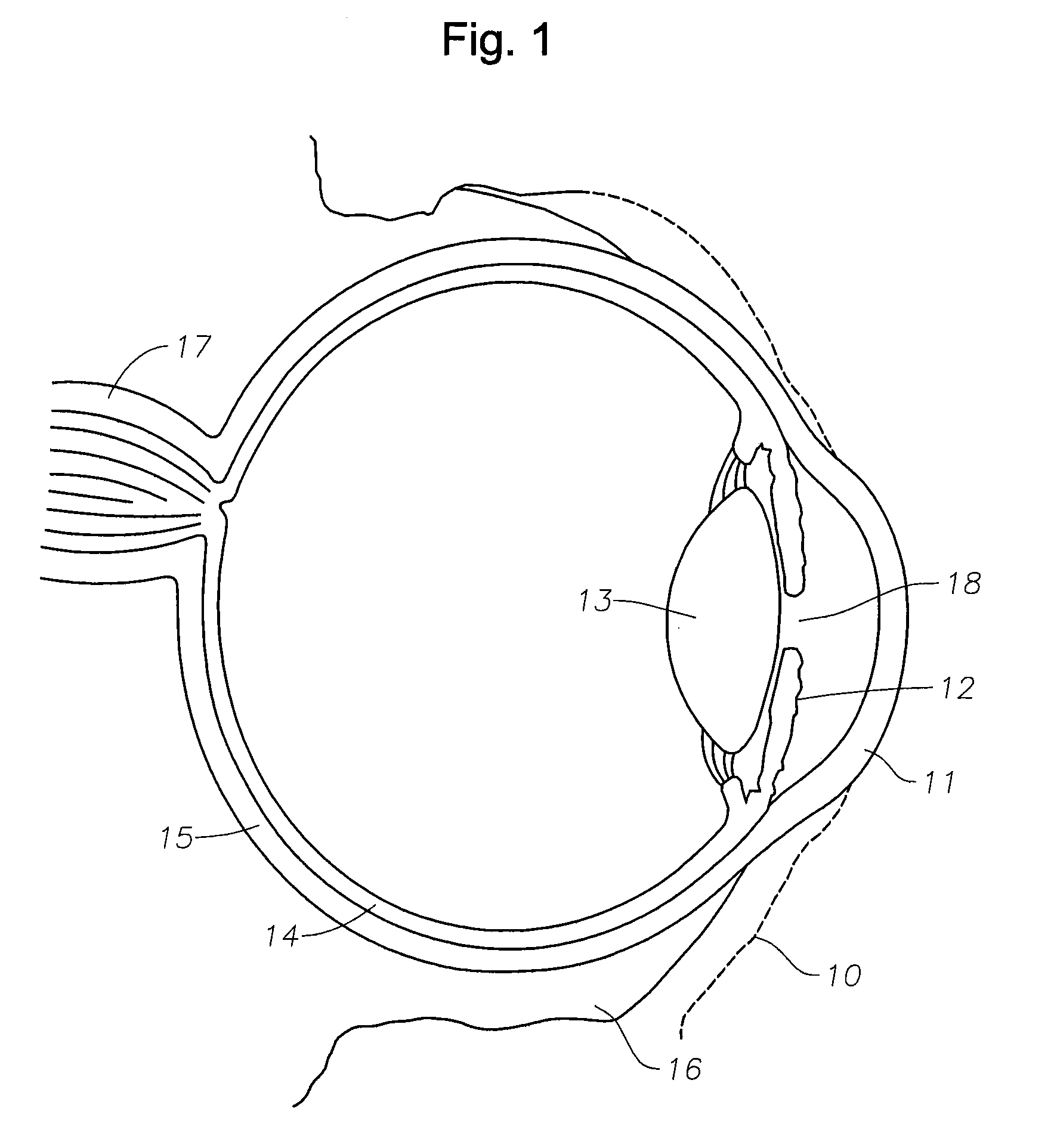Devices and methods for ophthalmic drug delivery