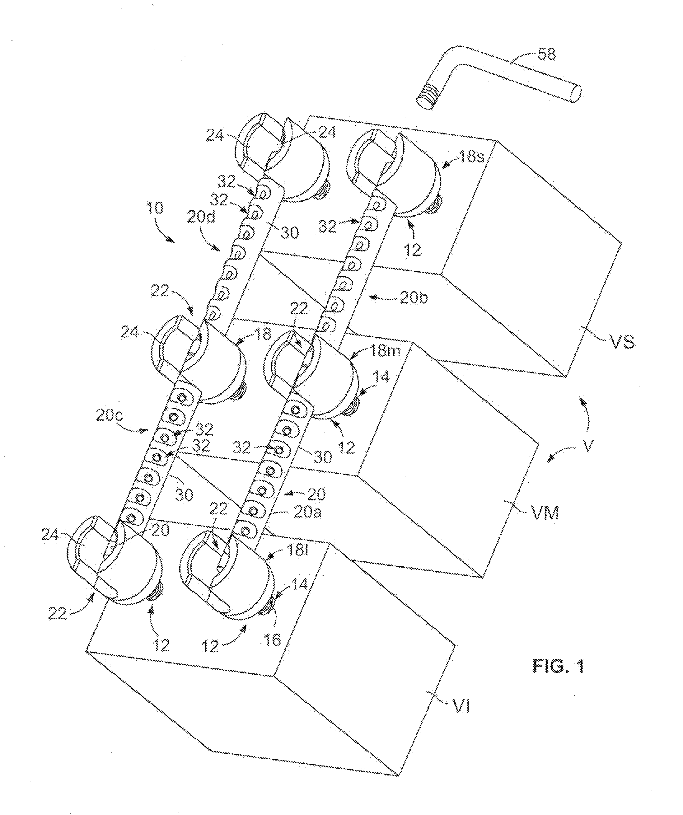 Systems and Methods for Spinal Stabilization