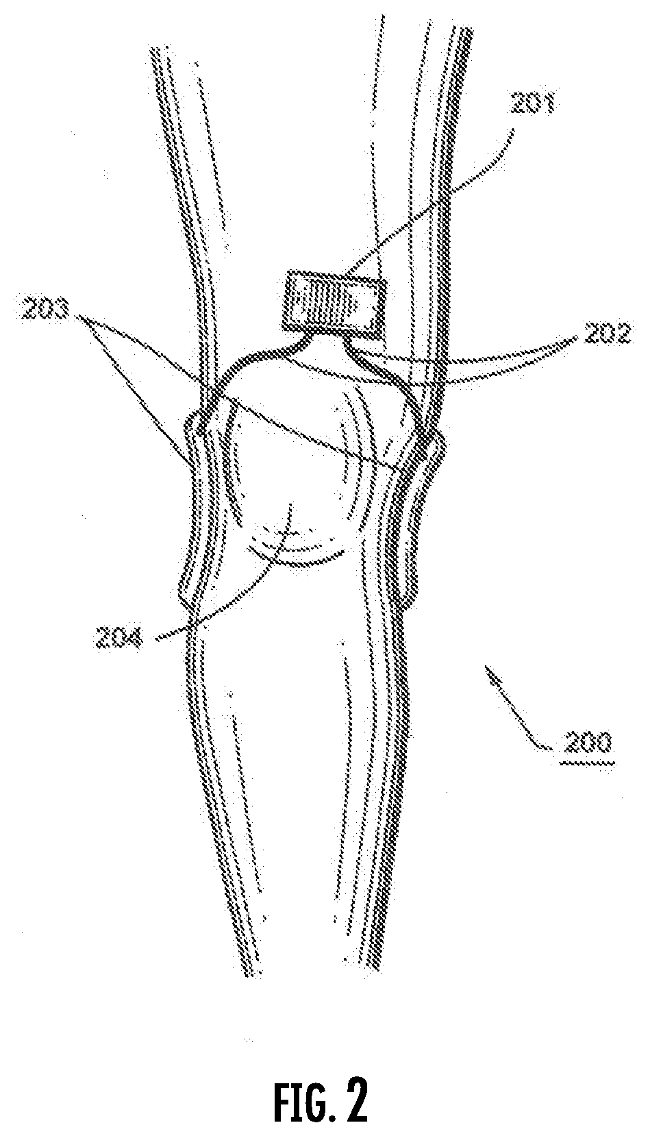 Method for treatment of non-alcoholic steatohepatitis using pulsed electromagnetic field therapy