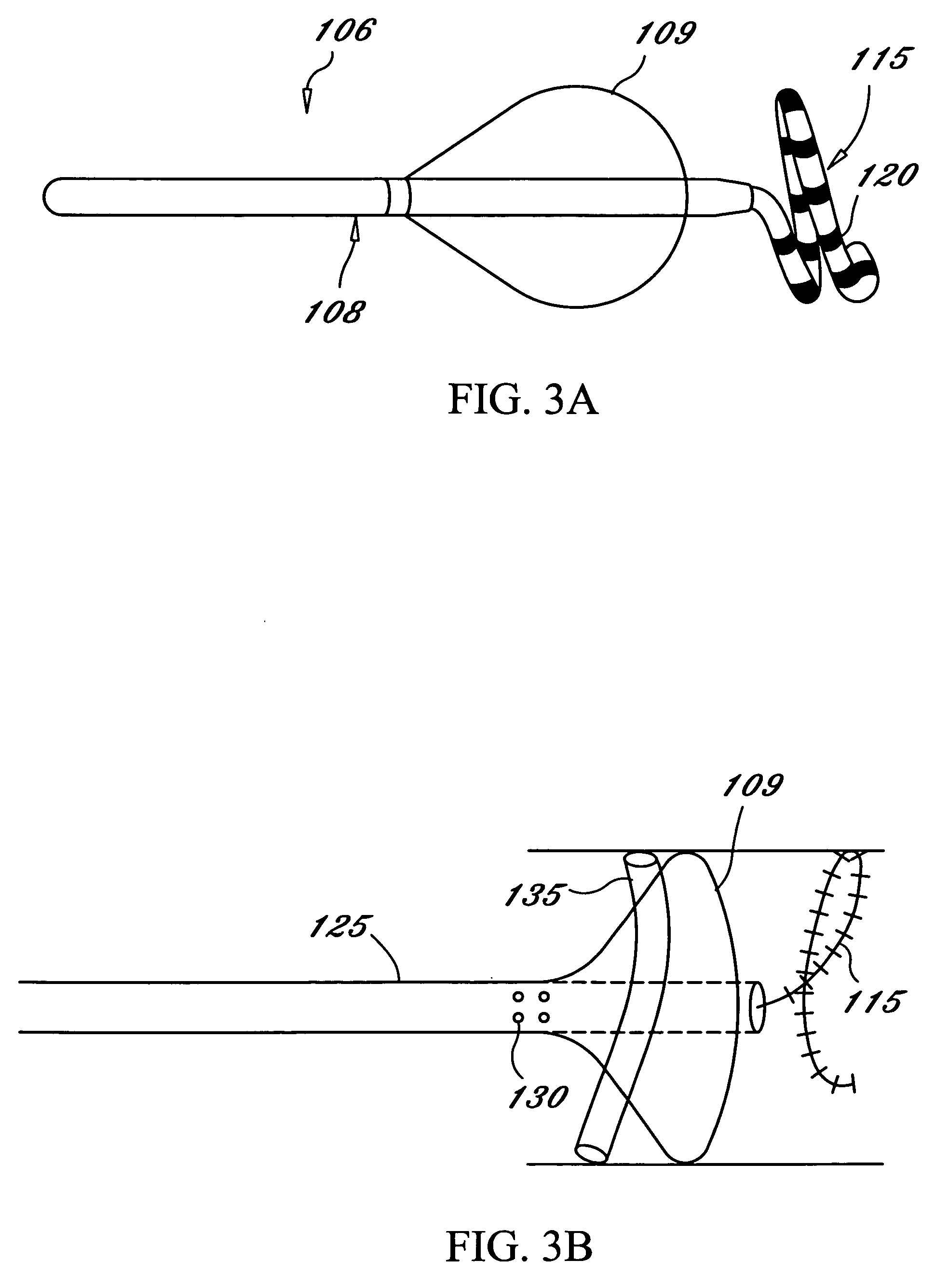 Tissue ablation system including guidewire with sensing element
