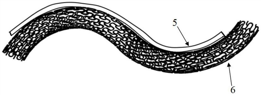 Non-uniform Poisson ratio vascular stent with controllable bending degree