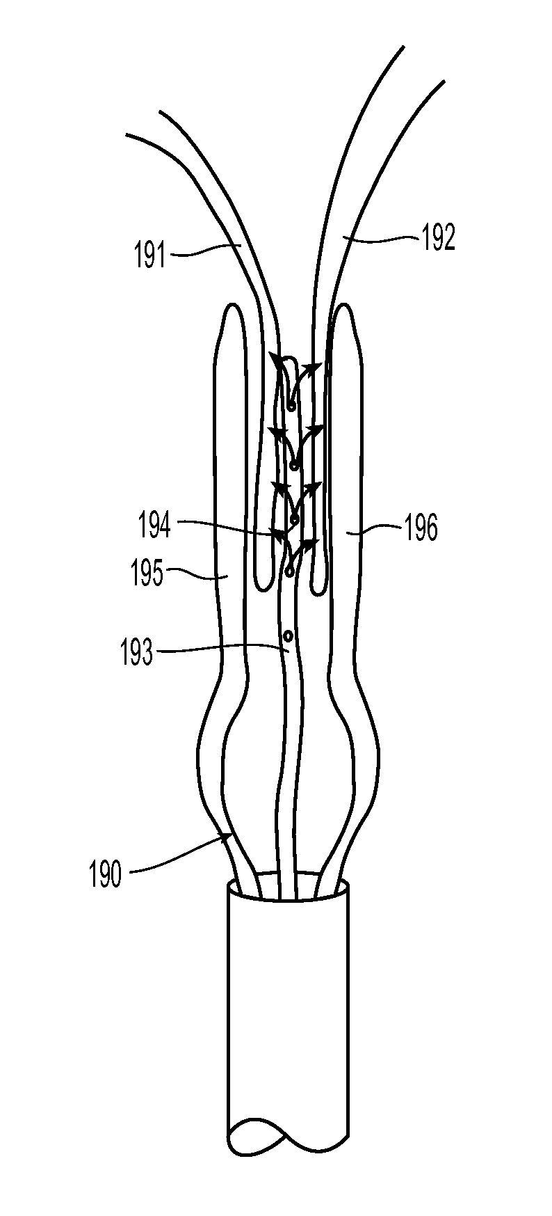 Systems and methods for endoluminal valve creation