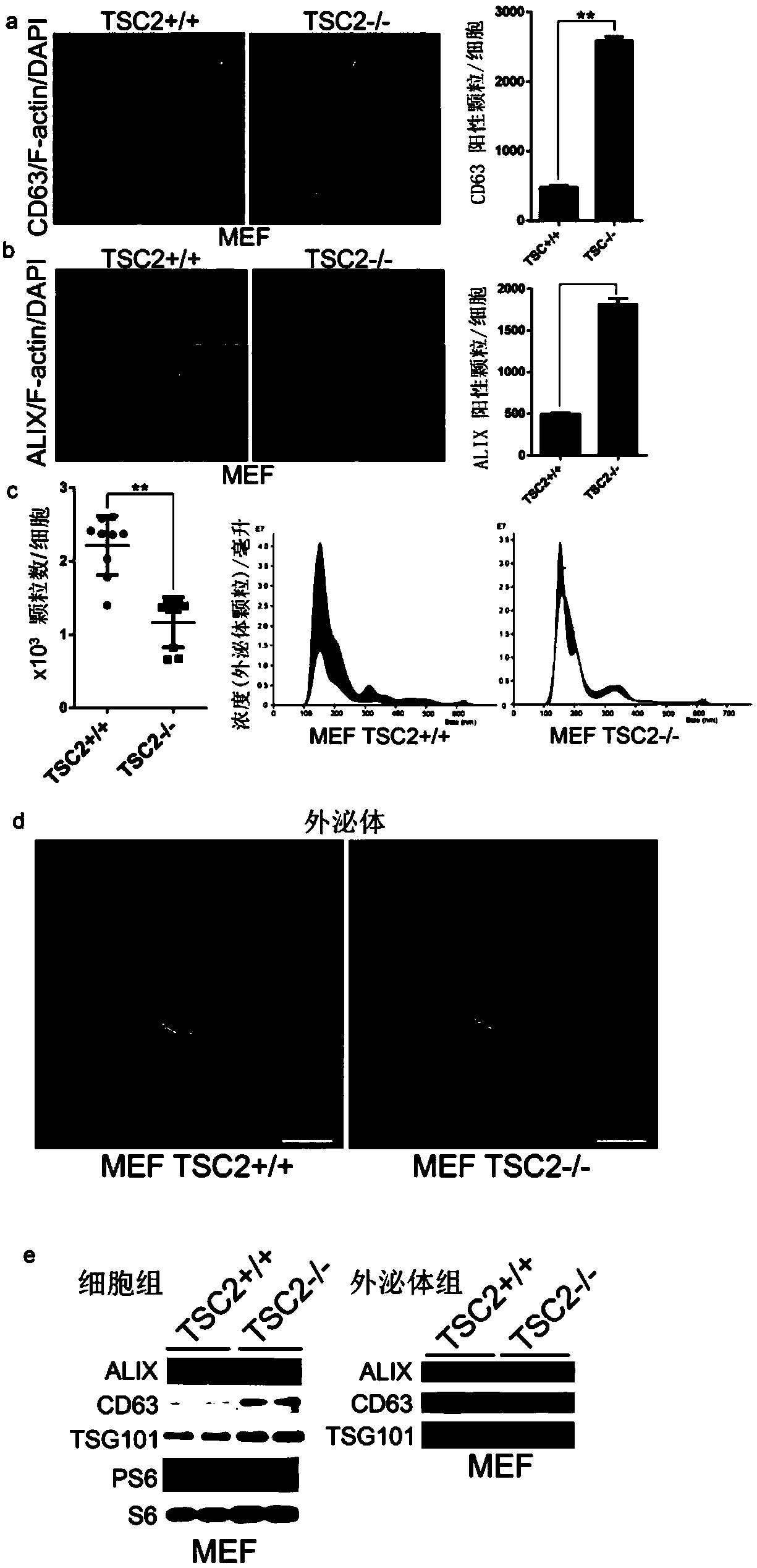 Method for regulating exosome release, and medical application of method