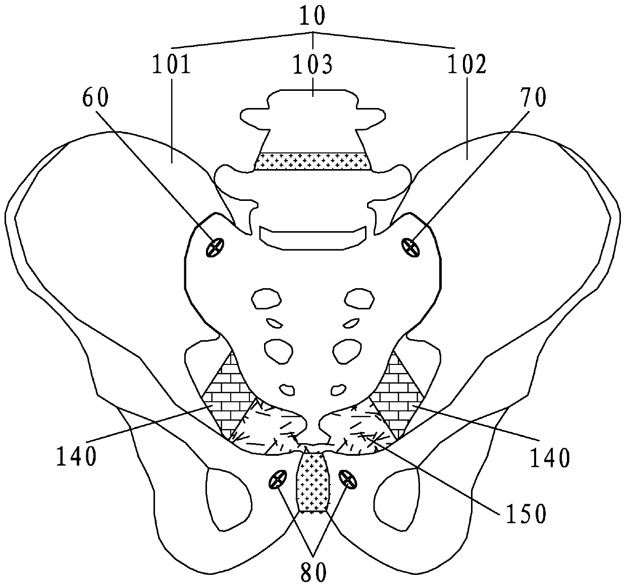 Female reproductive system anatomy teaching aid