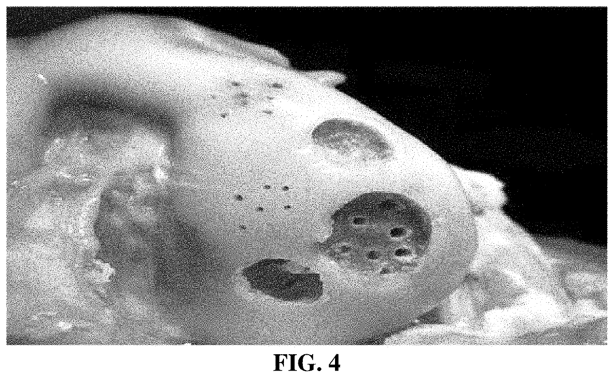 Preparation method and usage method for cartilage tissue recovery collagen