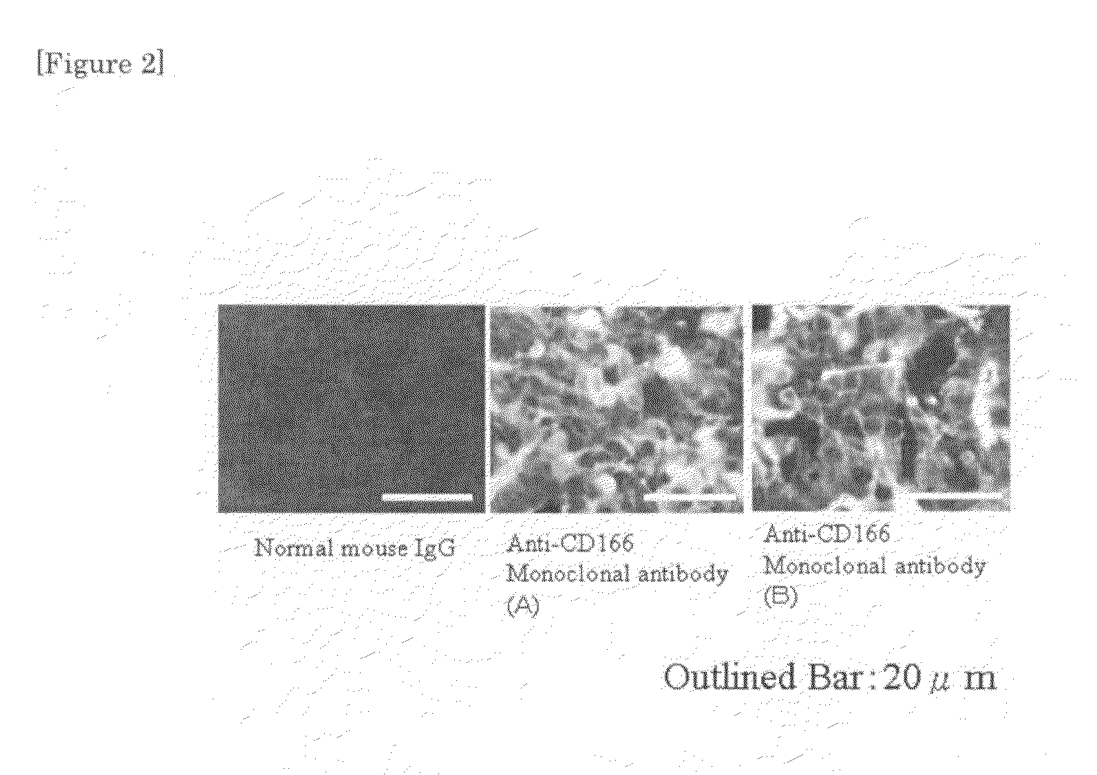 Monoclonal antibody to CD166 and method for production thereof