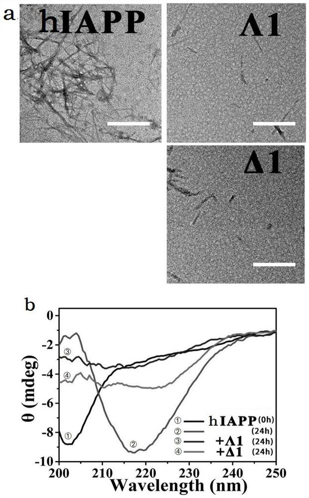 Sugar-modified metal helical complex, preparation method thereof and application of complex as amyloid protein degradation device