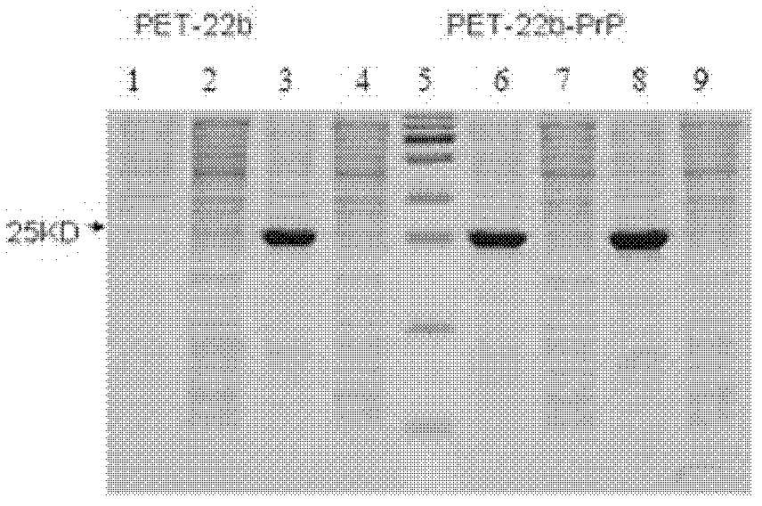 A kind of prion protein antibody and its preparation method and application