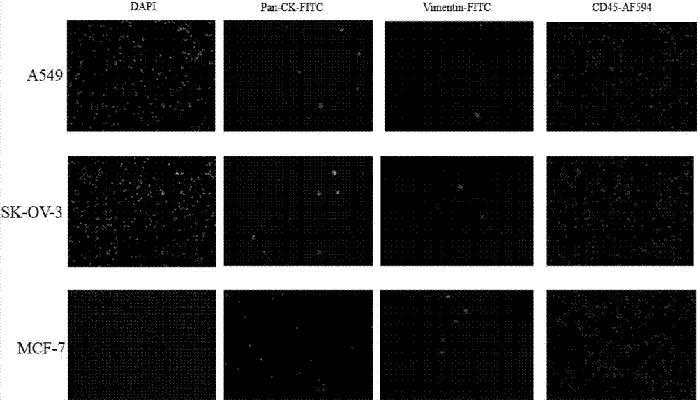 Immunofluorescent staining and interpretation method for circulating tumor cell