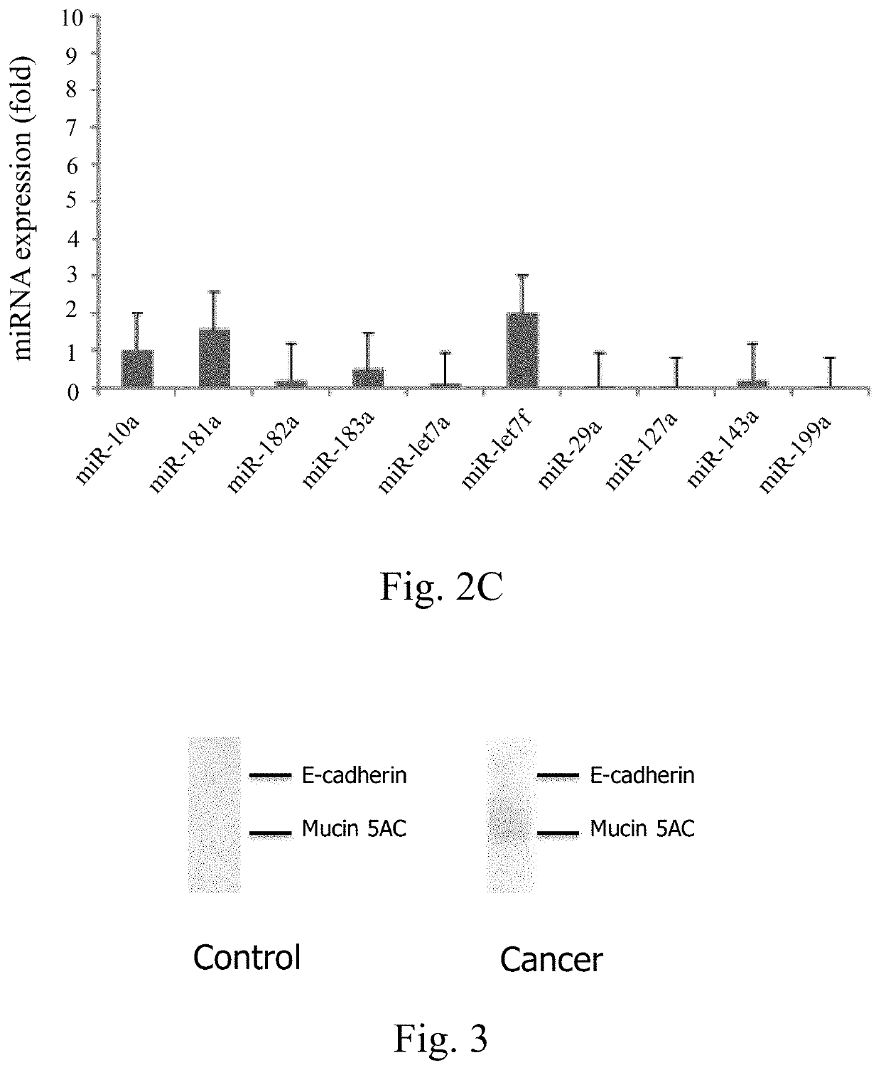 Methods of diagnosing diseases by extracellular vesicles and uses thereof
