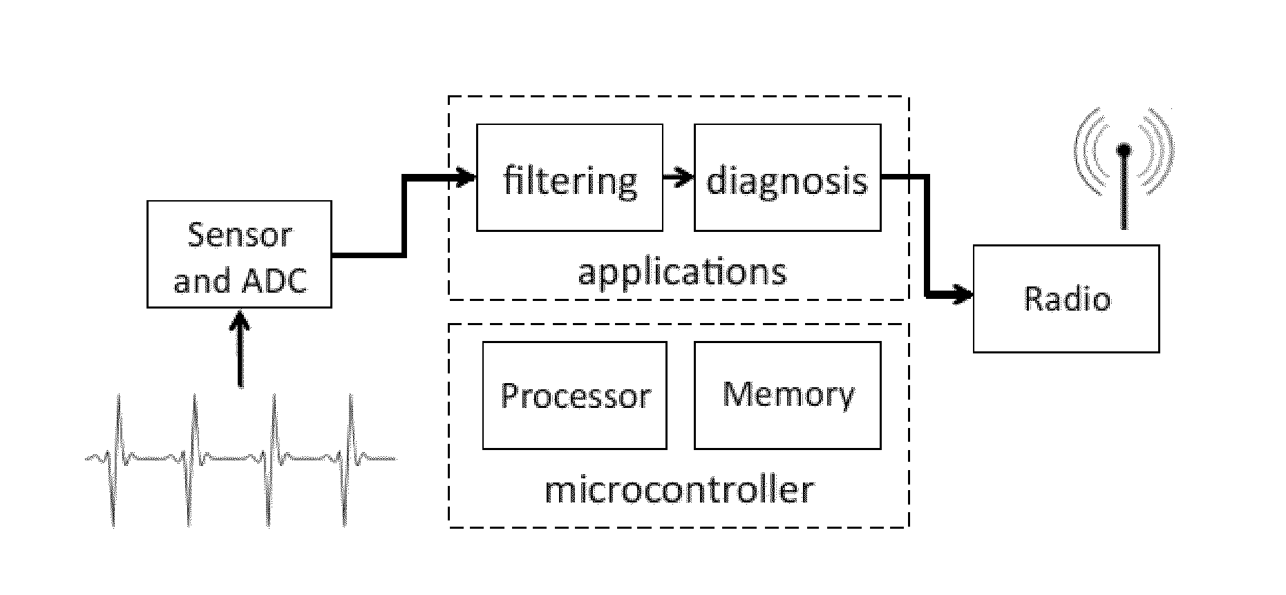 Method for detecting abnormalities in an electrocardiogram