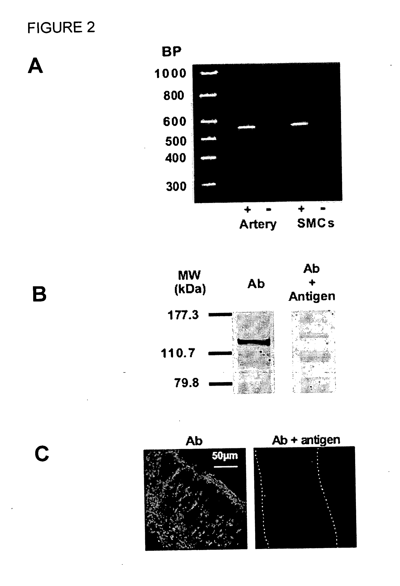 Methods and products for treating hypertension by modulation of TRPC3 channel activity
