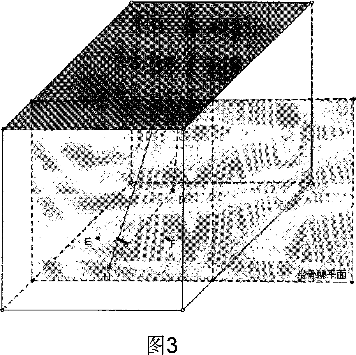 Device and method for supervising birth process