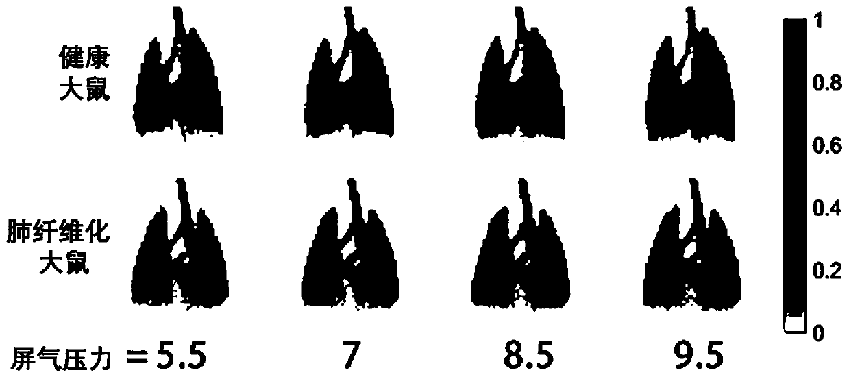 Quick magnetic resonance imaging method for lung compliance quantitative assessment