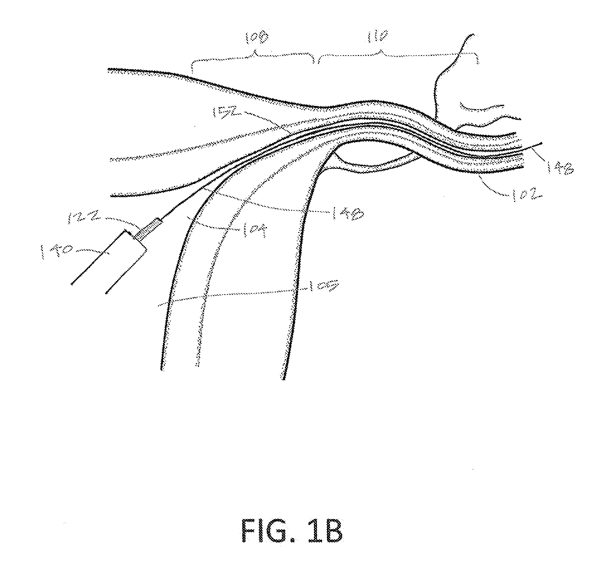 Systems and methods for permanent female contraception