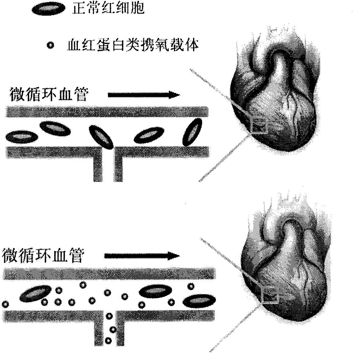 Combined cardiac arrest preserving fluid, preparation method and application thereof